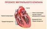 Берут ли в армию с тахикардией, отсрочка и освобождение от армии